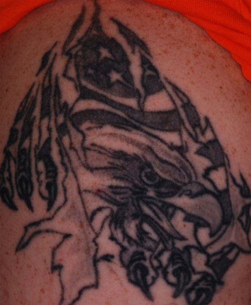 TATTOO removal pulse light clinic - skull before