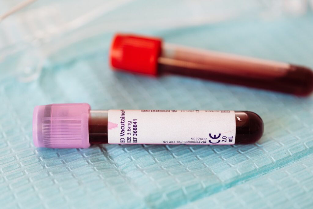 5 Essential Safety Principles for Phlebotomy Technicians to Prevent Infection | Health | Elle Blonde Luxury Lifestyle Destination Blog 